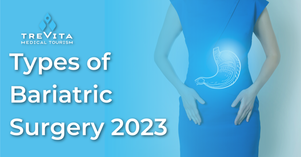 Types of Bariatric Surgery 2023: Gastric Sleeve, Gastric Bypass, Mini Gastric Bypass, and the Duodenal Switch.