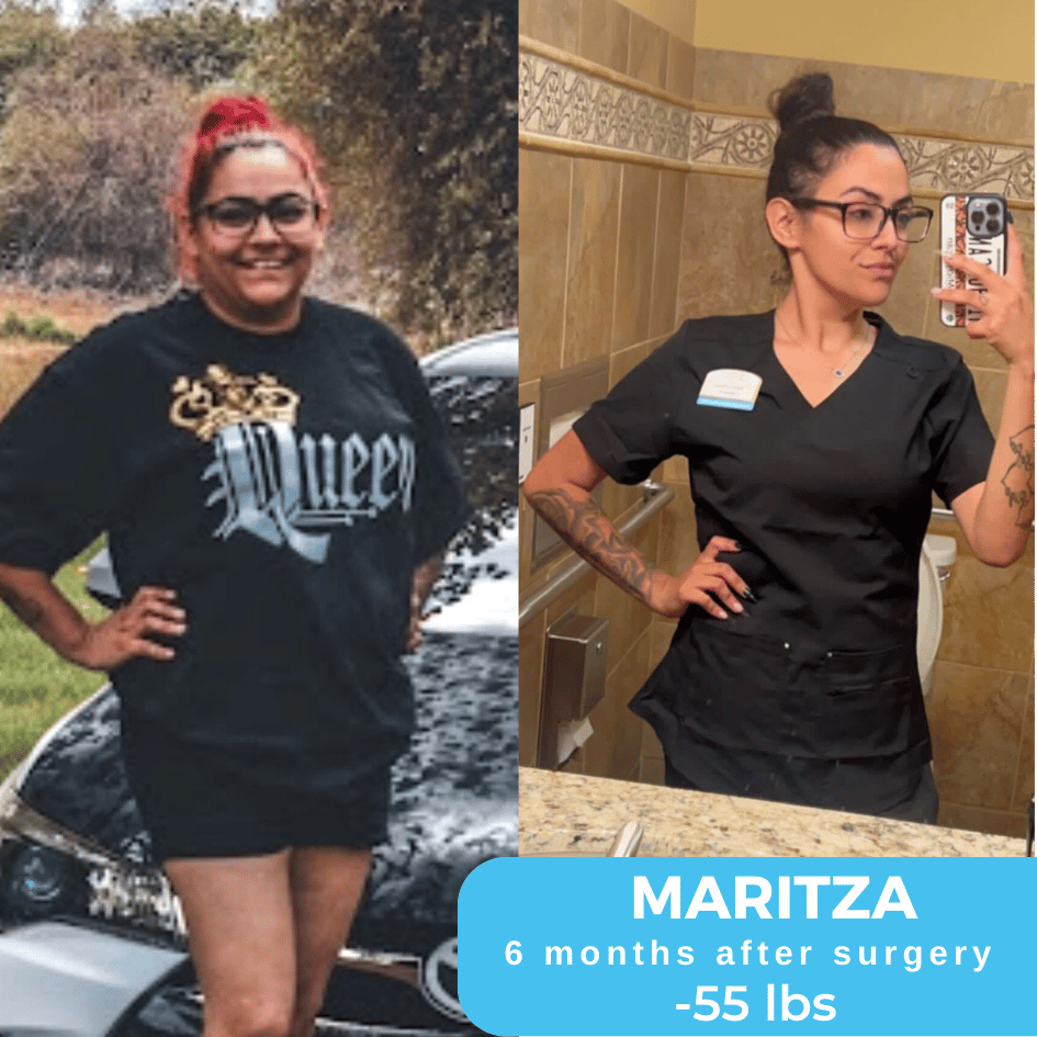 Maritza Before & After Bariatric Surgery