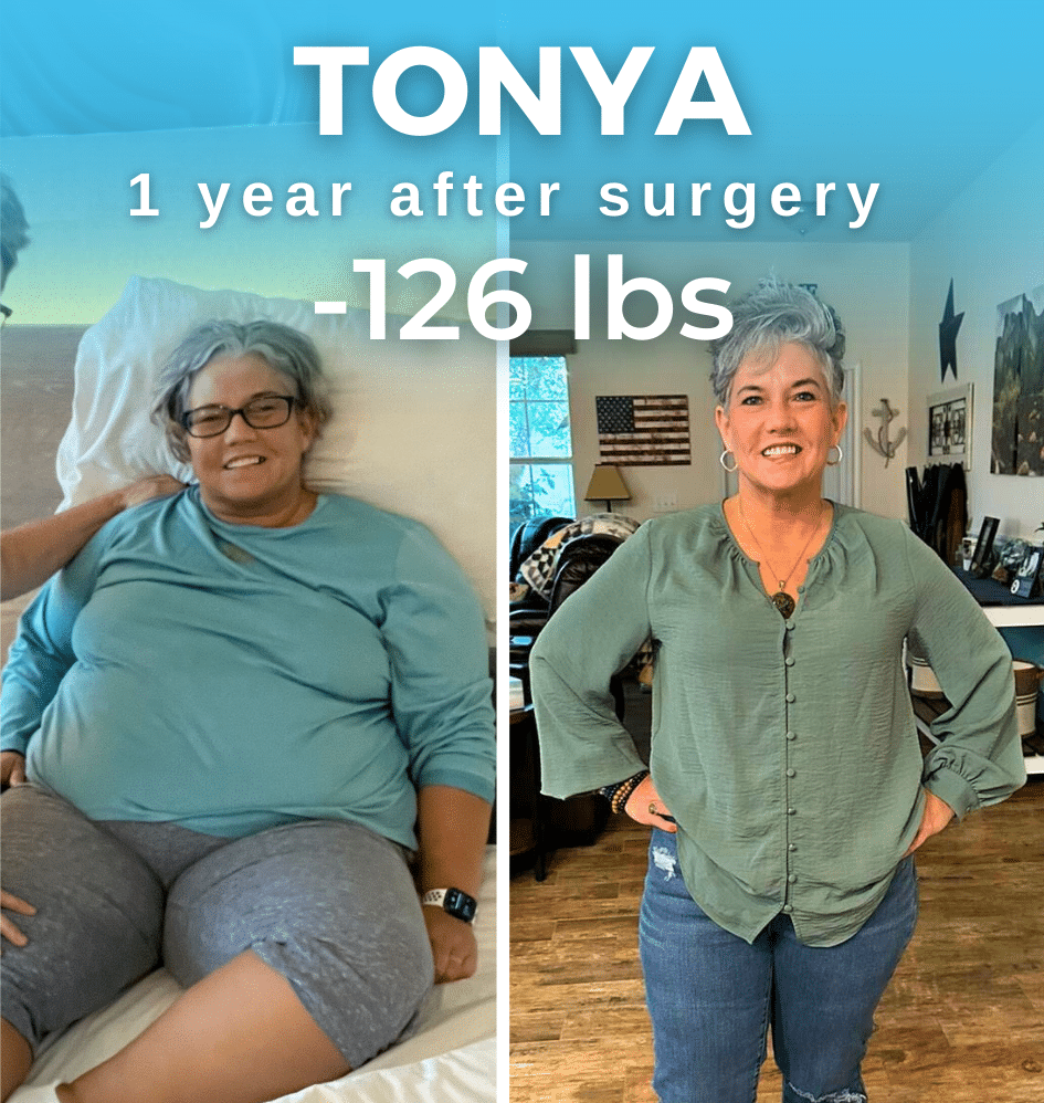 Gastric Sleeve Client Tonya