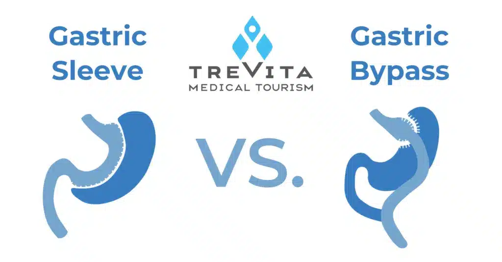 Comparing Gastric Sleeve and Gastric Bypass Outcomes