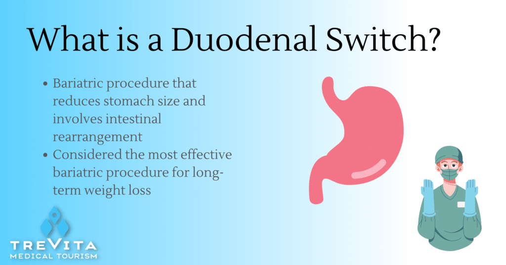 What a duodenal switch is and why it is the most effective bariatric procedure