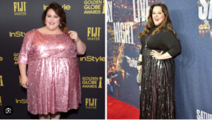 Chrissy Metz weight loss surgery