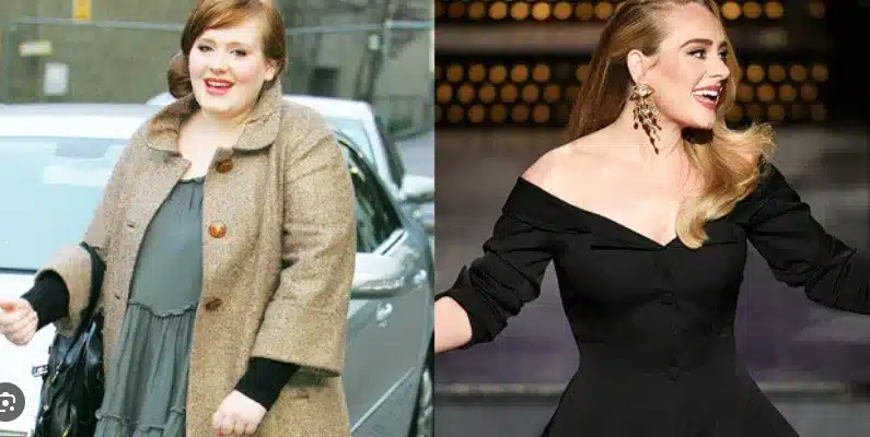 Adele before and after weight loss surgery 
