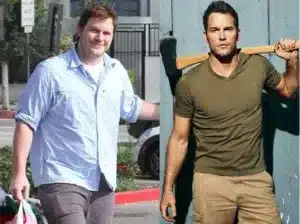 Chris Patt before and after weight loss surgery 