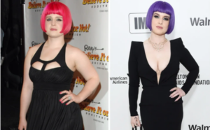 Kelly Osbourne weight loss surgery