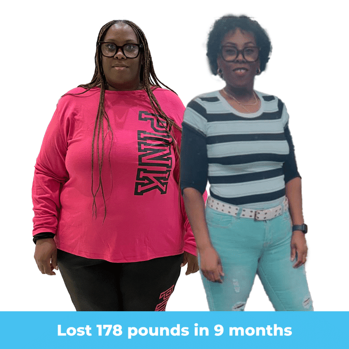 Athena's before and after transformation with Dr. Mendiola at TreVita.