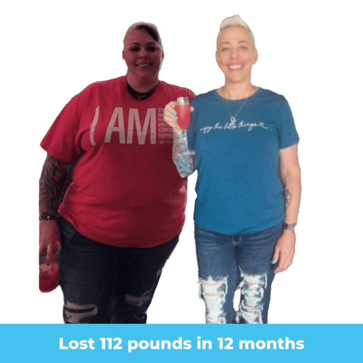 Christie's Transformation: Before and After with Dr. Mendiola at TreVita