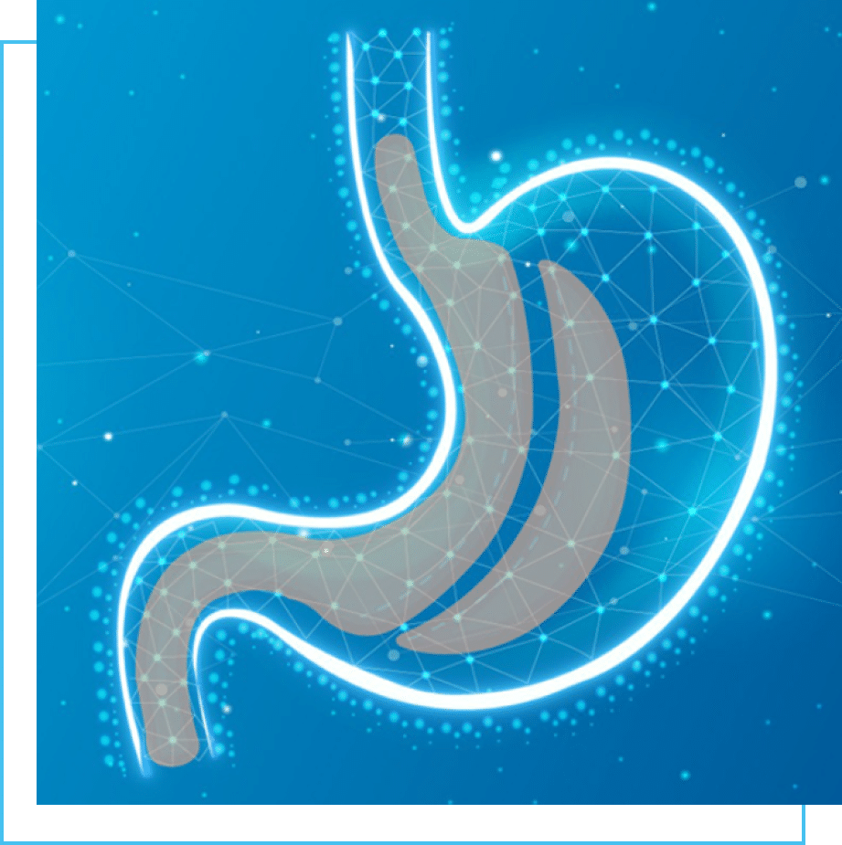 Revision surgery graphic with offset frame