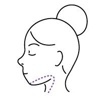 ChinLipo Illustration