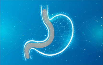 Gastric Sleeve Surgery in Mexico for Lasting Weight Loss