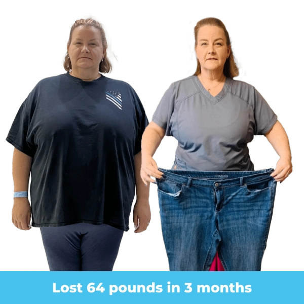 Bariatric Surgery Tijuana