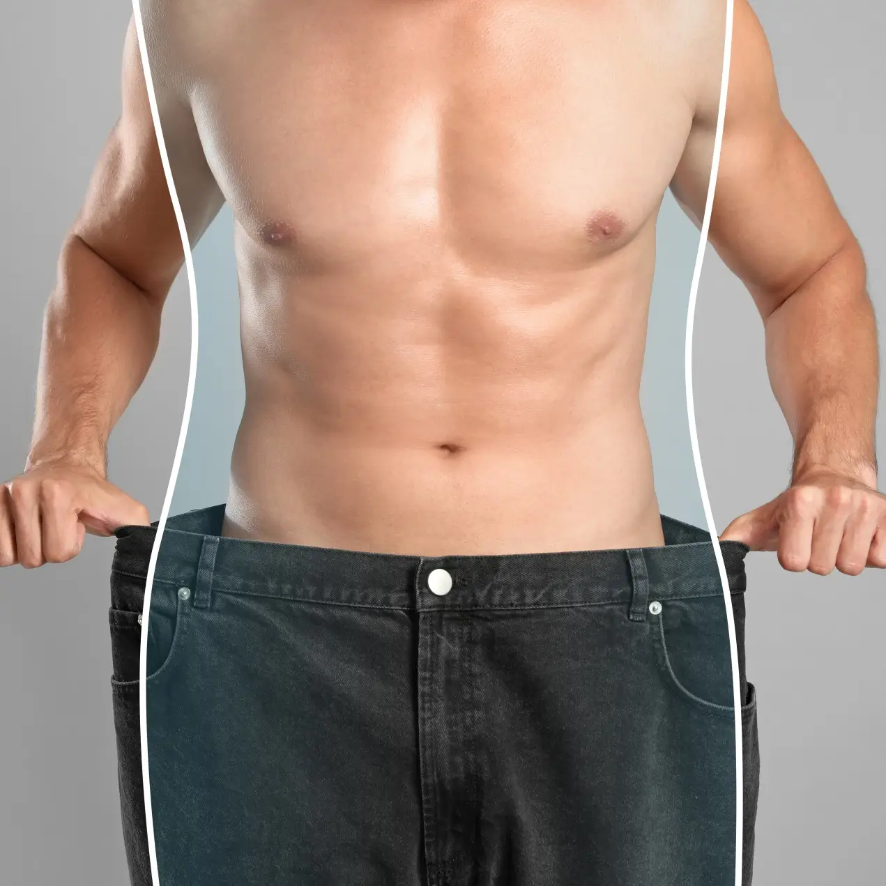 Liposuction