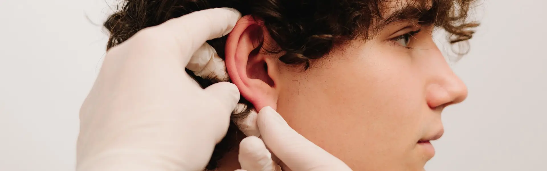 Otoplasty in Mexico