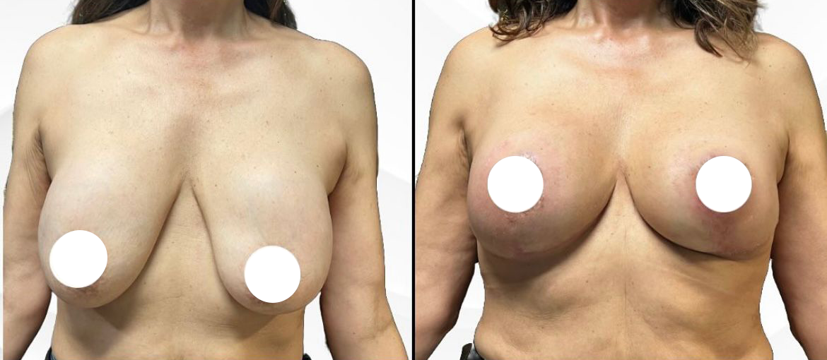 a4af37f8-30c9-48eb-8447-261bda5b7cce-hurtado-blwi-1