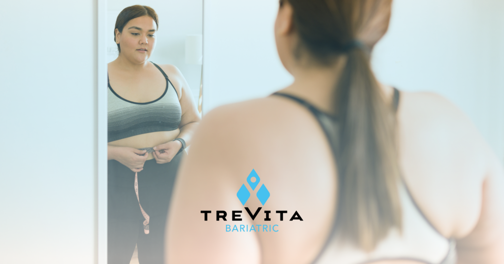 types of bariatric surgery, bariatric surgery mexico, how many steps to lose weight, weight-loss surgery