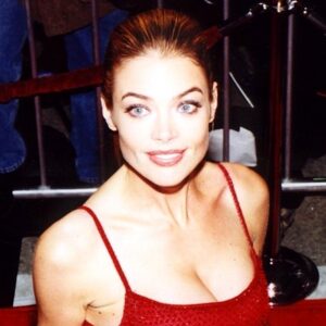 Denise Richards plastic surgery, face lift before and after, deep plane facelift, celebrity plastic surgery, Denise Richards facelift