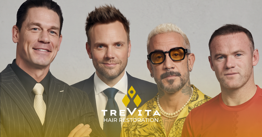 hair transplant