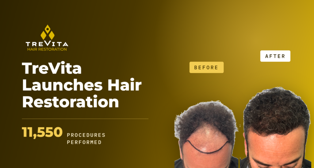 hair transplant, hair restoration, hair transplants in tijuana, hair loss