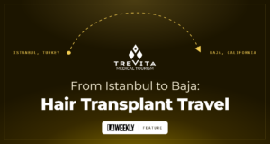 hair transplant, turkey hair transplants, hair restoration